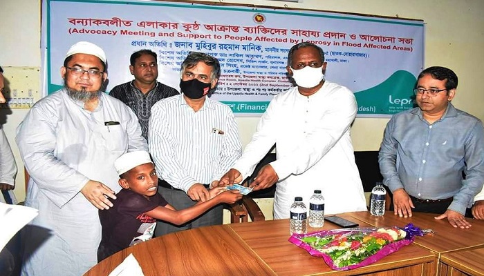 ‘কুষ্ঠ রোগী এখন সমাজ কিংবা পরিবারের বোঝা নয়’
