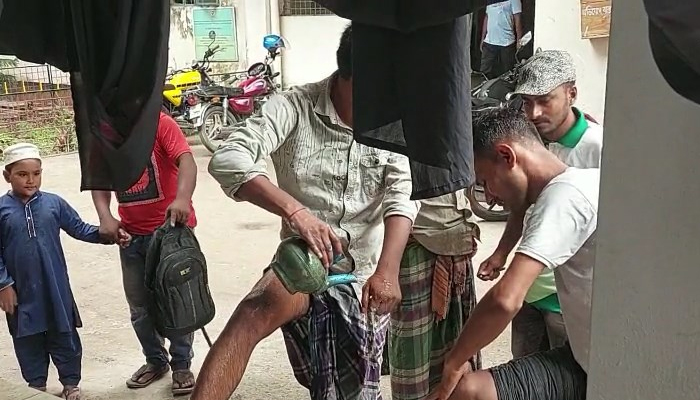 কালীগঞ্জে কুকুরের কামড়ে নারী-শিশু সহ ৪০ জন আহত