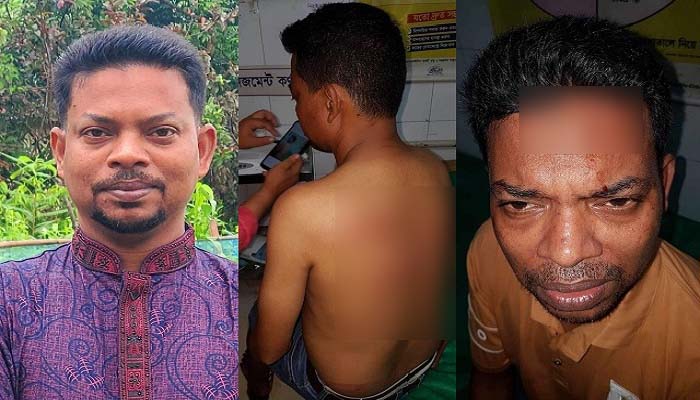 দিরাইয়ে সাংবাদিকের ওপর সন্ত্রাসী হামলা