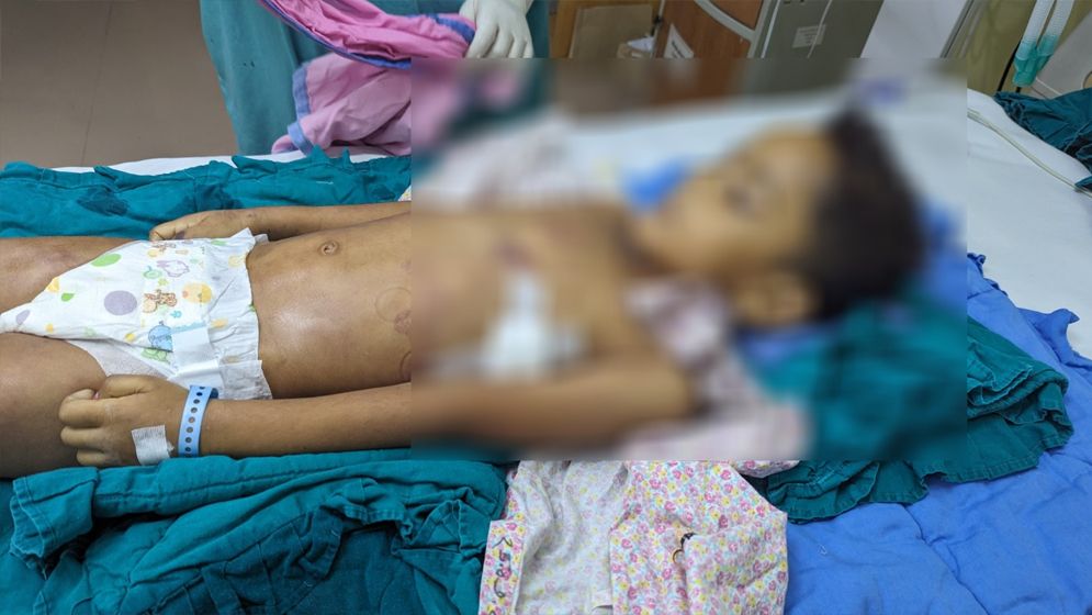 সুন্নতে খৎনা করতে গিয়ে জীবনটাই গেল ৫ বছরের আয়ানের