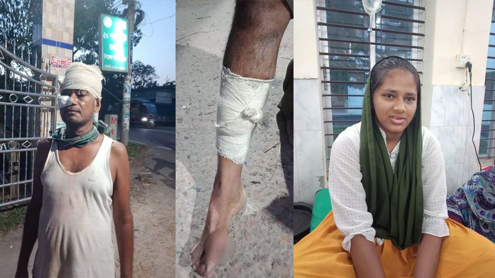 স্কুল ছাত্রীকে মারধর ও বাবাকে কুপিয়ে জখম 