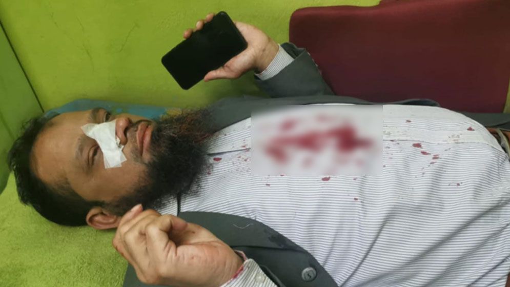 সোনারগাঁয়ে অবৈধ গ্যাস সংযোগ বিচ্ছিন্ন অভিযানে হামলা, আহত ৫
