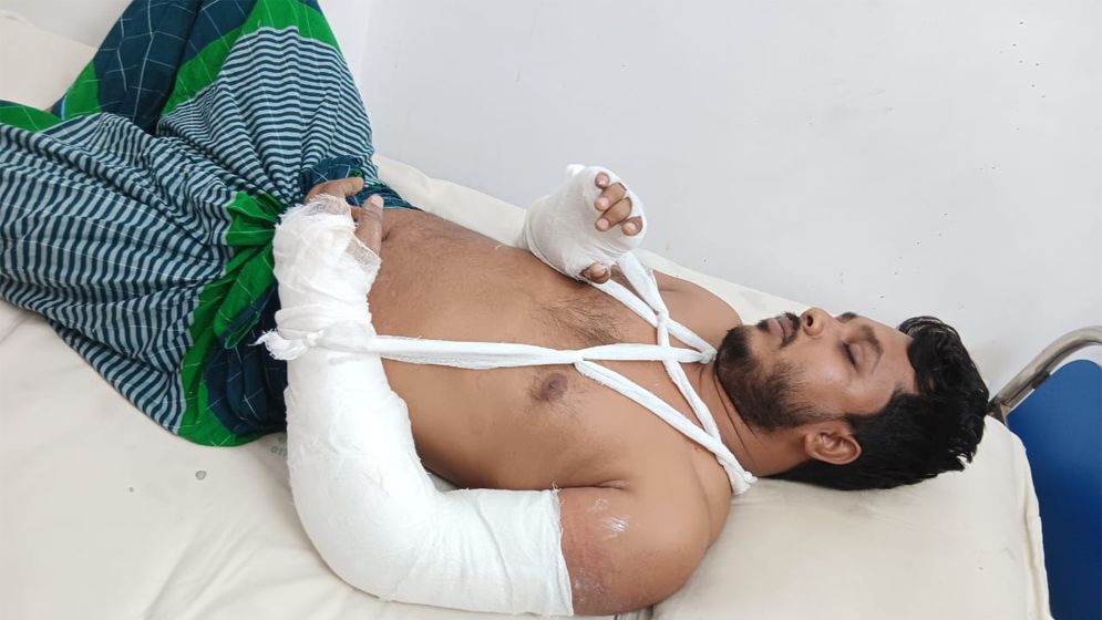 শিক্ষকের দুই হাত ভেঙ্গে দিল কিশোর গ্যাং