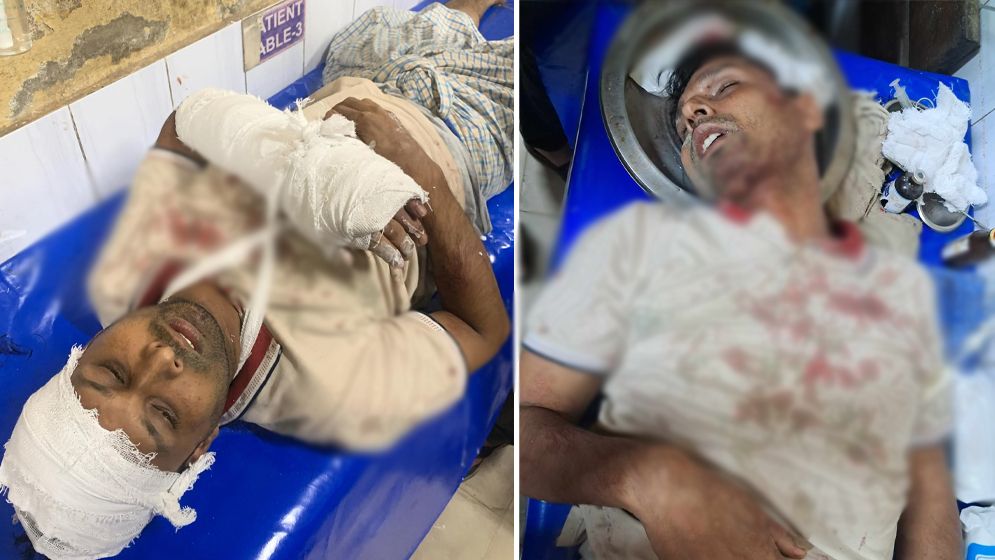 সোনাগাজীতে যুবলীগ নেতা আমজাদকে কুপিয়ে হত্যার চেষ্টা