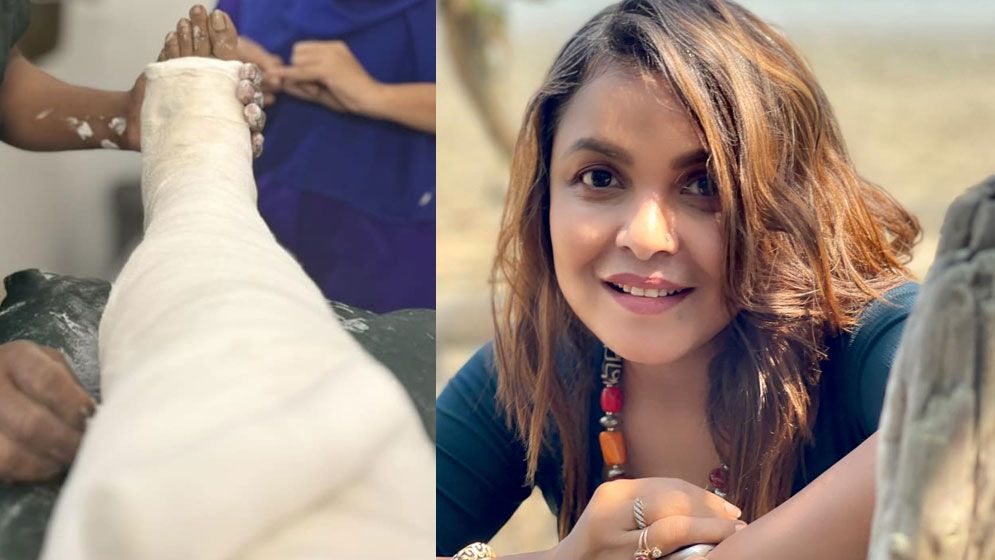 অটোর ধাক্কায় পা ভাঙল শাওনের, চালককে জানালেন ধন্যবাদ
