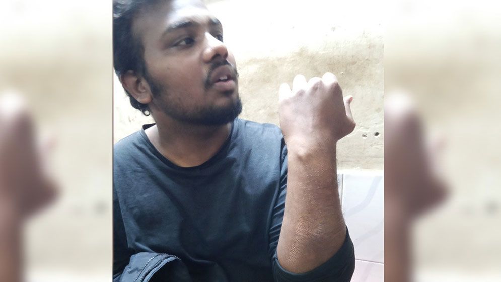 বৈষম্যবিরোধী আন্দোলনের সংগঠককে পেটাল নিষিদ্ধ ছাত্রলীগ