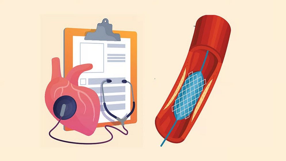 হার্টের রিংয়ের দাম কমলো, ১১ মডেলের নতুন মূল্য নির্ধারণ