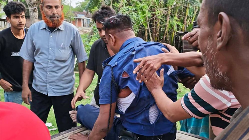 চাটমোহরে চলন্ত ট্রেন থেকে পড়ে পুলিশ আহত