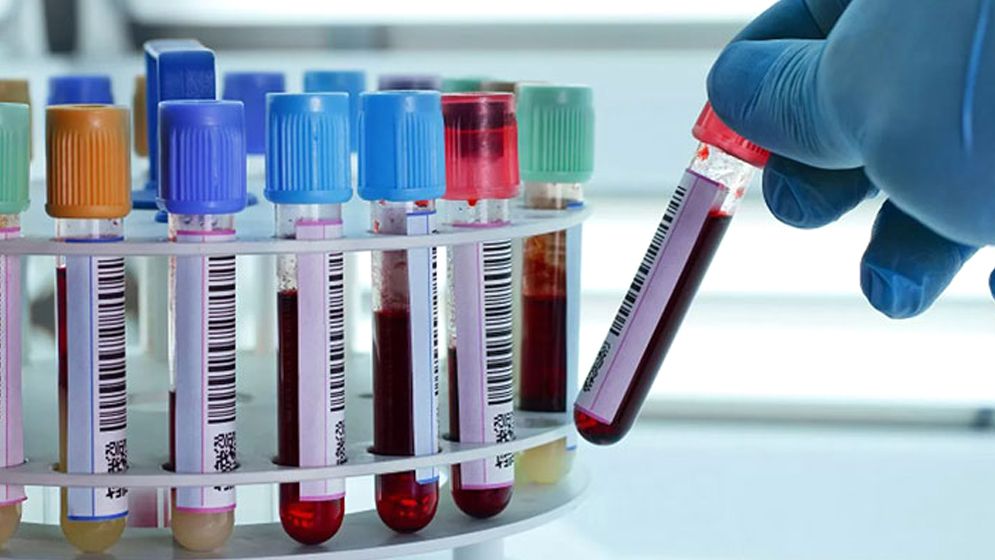 বরিশালের দুই পুলিশ সদস্য ডোপ টেস্টে পজিটিভ 