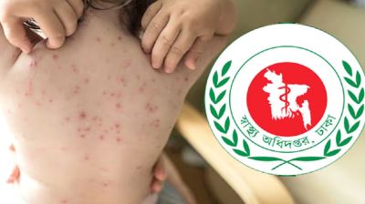 দেশে হামের উপসর্গ নিয়ে একদিনে মৃত্যু ১১