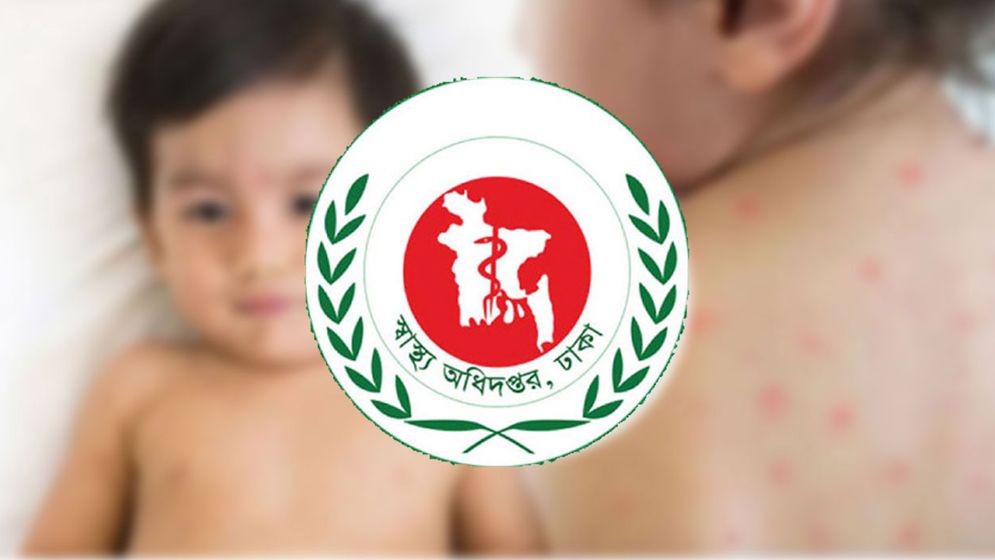 একদিনে হাম ও উপসর্গে আরো ৯ শিশুর মৃত্যু